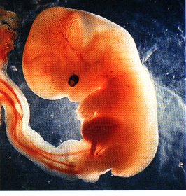 foetus-1-mois-MPI