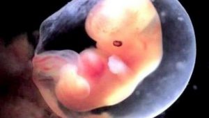 recherche-embryon-MPI