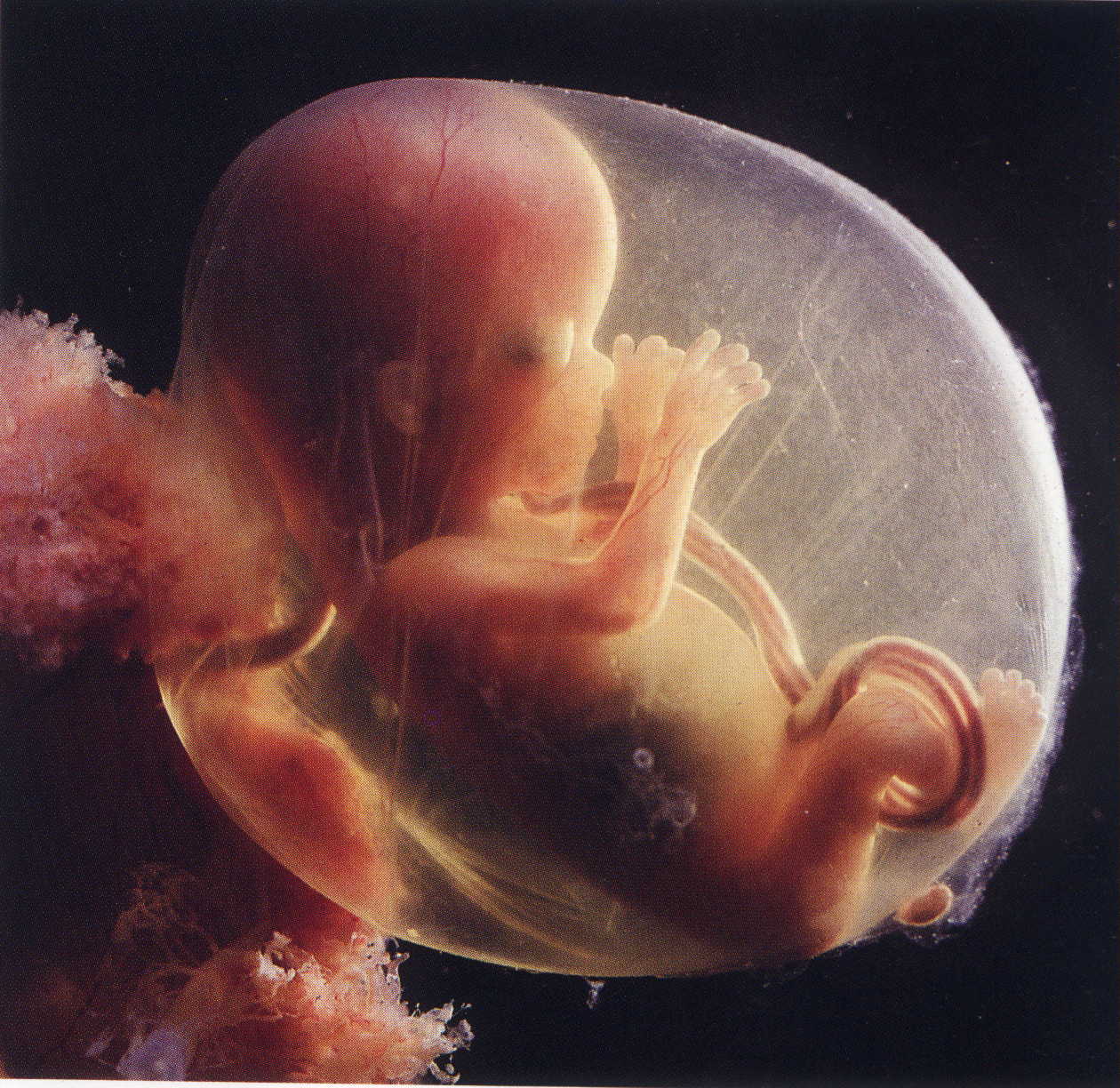 Человек в утробе матери. Эмбрион на 17 неделе беременности. Эмбрион на 14 неделе беременности. 13-14 Недель беременности фото плода.